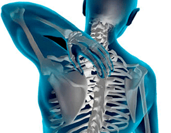 Manifestations of thoracic spine osteochondrosis